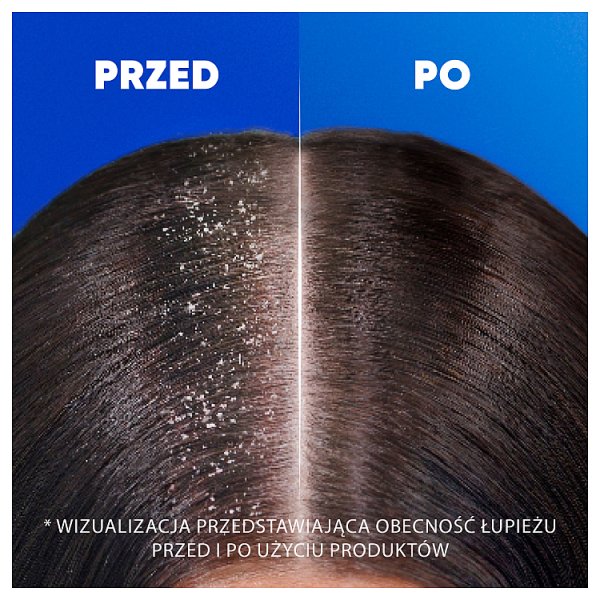 Head &amp; Shoulders Sensitive Scalp Codzienny Szampon Przeciwłupieżowy 400 ml
