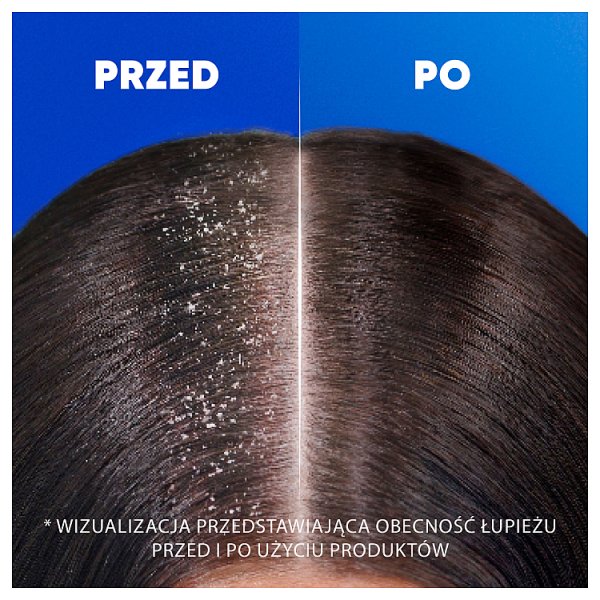 Head &amp; Shoulders Citrus Fresh Codzienny Szampon Przeciwłupieżowy 400 ml do Włosów Tłustych