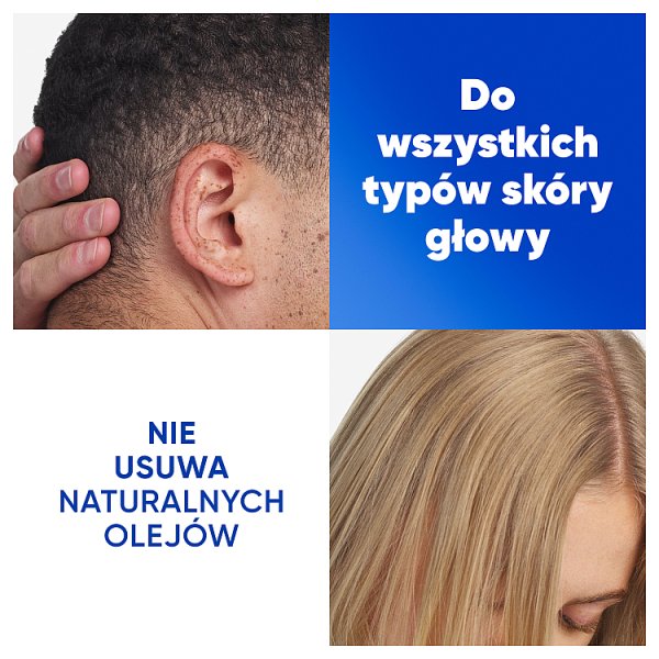 Head &amp; Shoulders Deep Hydration Szampon Przeciwłupieżowy 400 ml z Olejem Kokosowym