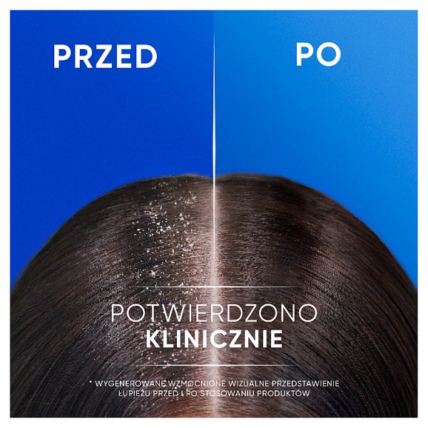 Head &amp; Shoulders Classic Clean Szampon Przeciwłupieżowy 2 w 1 330 ml. Świeży Zapach