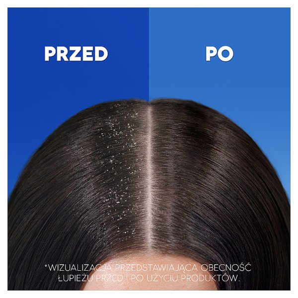 Head &amp; Shoulders Menthol Fresh 2 w 1 Szampon przeciwłupieżowy z odżywką – usuwa do 100% łupieżu